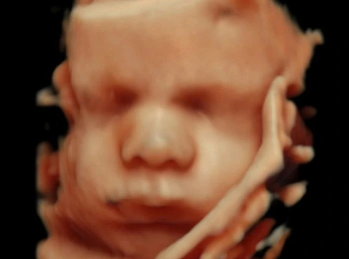 HDLive ultrasound of a baby's face with a hand beside the jaw
