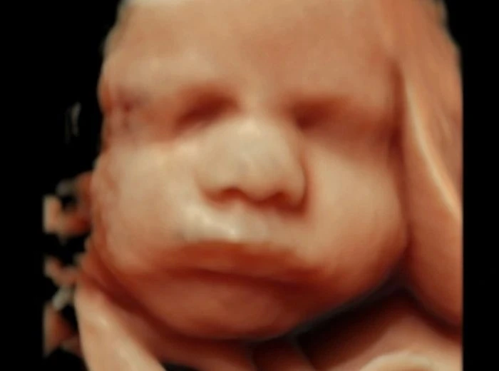 4D ultrasound portrait of a baby resting against a hand