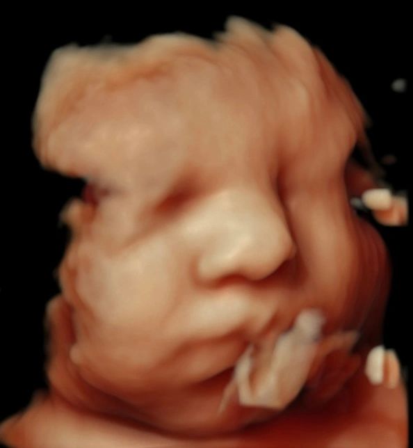 4D ultrasound image of a baby resting with a hand near their face