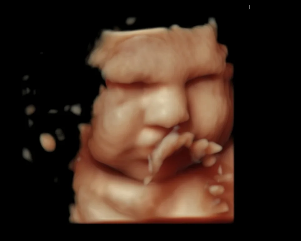 3D ultrasound still image of a baby's face and hand