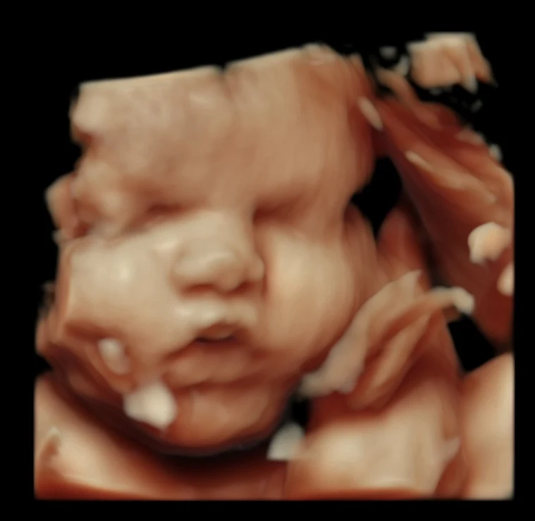 An ultrasound still showing a baby’s face beside a raised hand.